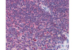IHC Information: Paraffin embedded spleen tissue, tested with an antibody dilution of 5 ug/ml. (IFIH1 抗体  (Middle Region))
