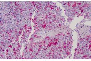 Human Tonsil: Formalin-Fixed, Paraffin-Embedded (FFPE) (Gelsolin 抗体  (AA 161-369))