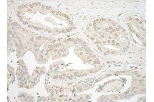 Immunohistochemistry (IHC) image for anti-Nuclear Factor of Activated T-Cells, Cytoplasmic, Calcineurin-Dependent 4 (NFATC4) (AA 300-350) antibody (ABIN7454864)