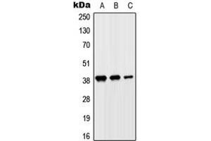 Western blot analysis of SLC10A7 expression in HeLa (A), HepG2 (B), H9C2 (C) whole cell lysates. (SLC10A7 抗体  (Center))