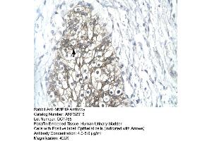 Human urinary bladder (MMP19 抗体  (C-Term))