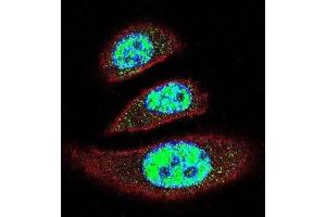 Immunofluorescence (IF) image for anti-tyrosyl-DNA phosphodiesterase 2 (TDP2) antibody (ABIN2996093) (TDP2 抗体)