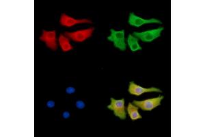 ABIN7095493 and ABIN7099550 staining Hela cells by IF/ICC.
