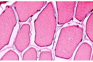 Human Skeletal Muscle: Formalin-Fixed, Paraffin-Embedded (FFPE) (Myoglobin 抗体)