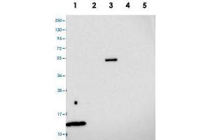 Western blot analysis of Lane 1: RT-4, Lane 2: U-251 MG, Lane 3: Human Plasma, Lane 4: Liver, Lane 5: Tonsil with MRPL35 polyclonal antibody . (MRPL35 抗体)