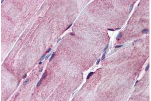 Human Skeletal Muscle: Formalin-Fixed, Paraffin-Embedded (FFPE) (SGCE 抗体  (AA 36-85))
