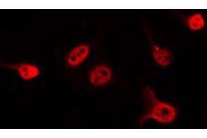 ABIN6274587 staining 293 by IF/ICC. (Apoptosis Inhibitor 5 抗体  (C-Term))