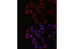 Immunofluorescence analysis of U2OS cells using YES1 Rabbit pAb (ABIN1683305, ABIN3015262, ABIN3015263 and ABIN6213907) at dilution of 1:250 (40x lens). (YES1 抗体  (AA 1-250))