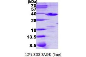SDS-PAGE (SDS) image for Phosducin-Like 3 (PDCL3) (AA 1-239) protein (His tag) (ABIN668014) (PDCL3 Protein (AA 1-239) (His tag))
