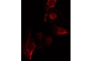 ABIN6275661 staining  COLO205 cells by IF/ICC. (YOD1 抗体  (Internal Region))