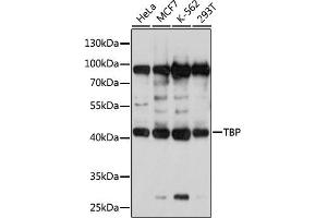 Western blot analysis of extracts of various cell lines, using TBP antibody (ABIN3023174, ABIN3023175, ABIN3023176 and ABIN1513589) at 1:1000 dilution. (TBP 抗体  (AA 1-100))