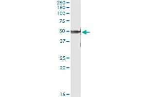Immunoprecipitation of PRKX transfected lysate using anti-PRKX monoclonal antibody and Protein A Magnetic Bead , and immunoblotted with PRKX MaxPab rabbit polyclonal antibody. (PRKX 抗体  (AA 269-358))