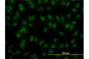 Immunofluorescence of monoclonal antibody to IRF2 on HeLa cell. (IRF2 抗体  (AA 216-315))