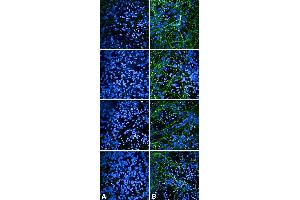 Immunocytochemistry/Immunofluorescence analysis using Rabbit Anti-Tau Monoclonal Antibody, Clone AH36 (ABIN6932902). (tau 抗体  (pSer202, pThr205) (FITC))
