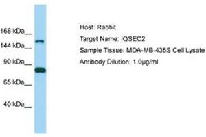 Image no. 1 for anti-IQ Motif and Sec7 Domain 2 (IQSEC2) (AA 351-400) antibody (ABIN6750202) (IQSEC2 抗体  (AA 351-400))