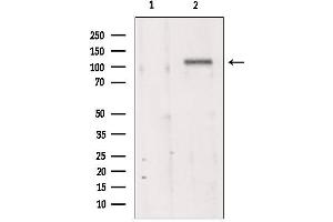 Western blot analysis of extracts from 293, using MKS3 antibody. (TMEM67 抗体  (Internal Region))