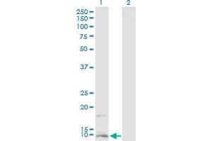 Western Blot analysis of CD59 expression in transfected 293T cell line by CD59 MaxPab polyclonal antibody. (CD59 抗体  (AA 1-128))