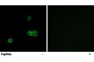 Immunofluorescence analysis of A-549 cells, using MARCH5 polyclonal antibody . (MARCH5 抗体)