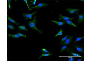 Immunofluorescence of purified MaxPab antibody to TRIT1 on HeLa cell. (TRIT1 抗体  (AA 1-467))