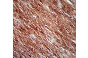 IL-2 antibody immunohistochemistry analysis in formalin fixed and paraffin embedded mouse heart tissue. (IL-2 抗体  (AA 50-77))