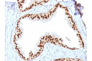 Formalin-fixed, paraffin-embedded human Prostate stained with FOXA1 Mouse Monoclonal Antibody (FOXA1/1512). (FOXA1 抗体  (AA 372-472))