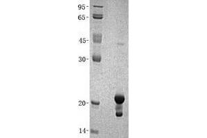 Western Blotting (WB) image for Non-Metastatic Cells 1, Protein (NM23A) Expressed in (NME1) (Transcript Variant 2) protein (His tag) (ABIN2726967)