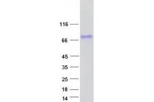Western Blotting (WB) image for OTU Domain Containing 5 (OTUD5) (Transcript Variant 1) protein (Myc-DYKDDDDK Tag) (ABIN2728059)
