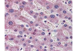 Human Liver: Formalin-Fixed, Paraffin-Embedded (FFPE) (AIF 抗体  (AA 593-606))