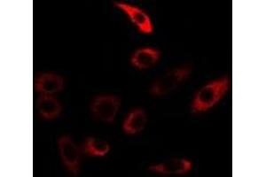 Immunofluorescent analysis of TGase5 staining in U2OS cells. (Transglutaminase 5 抗体)