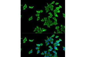 Immunofluorescence analysis of U2OS cells using HTR2B Polyclonal Antibody (Serotonin Receptor 2B 抗体)