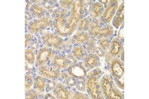 Immunohistochemistry of paraffin-embedded rat kidney using PAK1 antibody. (PAK1 抗体)
