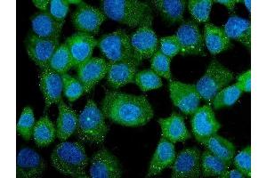 IF analysis of CCT3 using anti-CCT3 antibody (ABIN5693184).