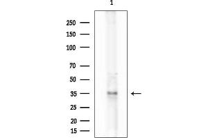 Western blot analysis of lysates from COLO205 cells, using OR51 Antibody at 1/1000 dilution.