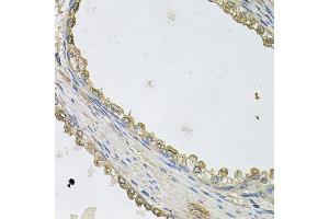 Immunohistochemistry of paraffin-embedded human prostate using MTERFD1 antibody. (MTERFD1 抗体)