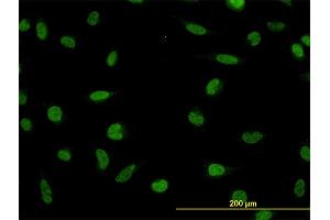 Immunofluorescence of monoclonal antibody to LDB2 on HeLa cell. (LIM Domain Binding 2 Protein 抗体  (AA 1-373))