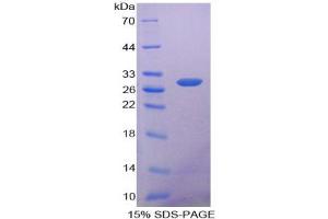 SDS-PAGE analysis of Human ANP32A Protein. (PHAP1 蛋白)