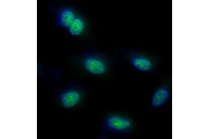 ICC/IF analysis of FUBP1 in HeLa cells line, stained with DAPI (Blue) for nucleus staining and monoclonal anti-human FUBP1 antibody (1:100) with goat anti-mouse IgG-Alexa fluor 488 conjugate (Green). (FUBP1 抗体)