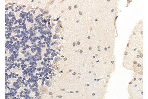 ABIN6265856 and ABIN6279905 at 1/100 staining Rat brain tissue by IHC-P. (UBE4A 抗体  (C-Term))
