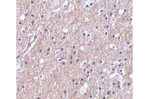 Immunohistochemistry of CTRP6 in human brain tissue with CTRP6 antibody at 10 μg/ml. (CTRP6 抗体  (Intermediate Domain))