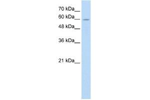 WB Suggested Anti-ANAPC7 Antibody Titration:  0. (ANAPC7 抗体  (C-Term))