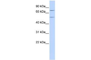 WB Suggested Anti-ZNF582 Antibody Titration:  0. (ZNF582 抗体  (N-Term))