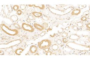 Detection of CR1 in Human Kidney Tissue using Polyclonal Antibody to Complement Receptor 1, Erythrocyte (CR1) (CD35 抗体  (AA 1780-2039))