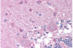 anti-Cholinergic Receptor, Nicotinic, beta 2 (Neuronal) (CHRNB2) (AA 21-70) antibody