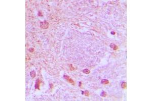 Immunohistochemistry (IHC) image for anti-Transcription Factor 3 (E2A Immunoglobulin Enhancer Binding Factors E12/E47) (TCF3) (C-Term) antibody (ABIN7297090)