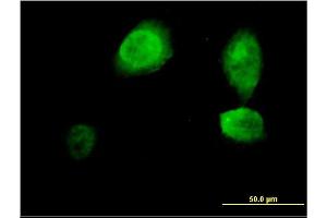 Immunofluorescence of monoclonal antibody to ING3 on HeLa cell. (ING3 抗体  (AA 1-92))