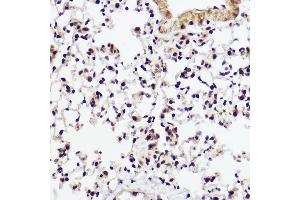 Immunohistochemistry of paraffin-embedded mouse lung using WBP11 Rabbit pAb (ABIN7271390) at dilution of 1:100 (40x lens). (WBP11 抗体  (AA 1-140))