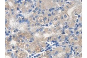 Detection of ME2 in Human Stomach Tissue using Polyclonal Antibody to Malic Enzyme 2, NADP+ Dependent, Mitochondrial (ME2) (Malic Enzyme 2, NADP+ Dependent, Mitochondrial (AA 220-426) 抗体)