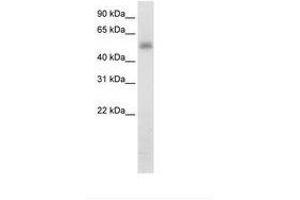 Image no. 2 for anti-Methyltransferase Like 3 (METTL3) (N-Term) antibody (ABIN202783) (METTL3 抗体  (N-Term))