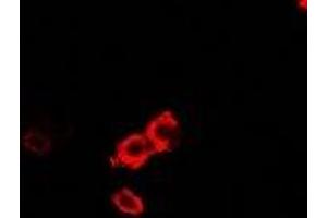 Immunofluorescent analysis of OGT staining in U2OS cells. (OGT 抗体)