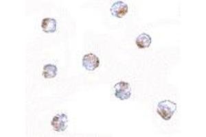 Immunocytochemistry of Aak1 in A-20 cells with AP30003PU-N Aak1 antibody at 5 μg/ml. (AAK1 抗体  (N-Term))